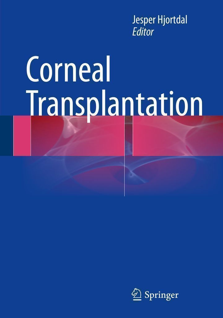 Cover image for Corneal Transplantation