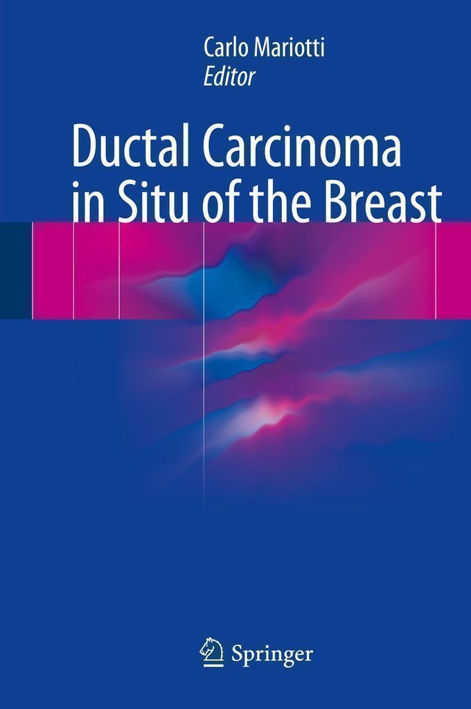 Cover image for Ductal Carcinoma in Situ of the Breast