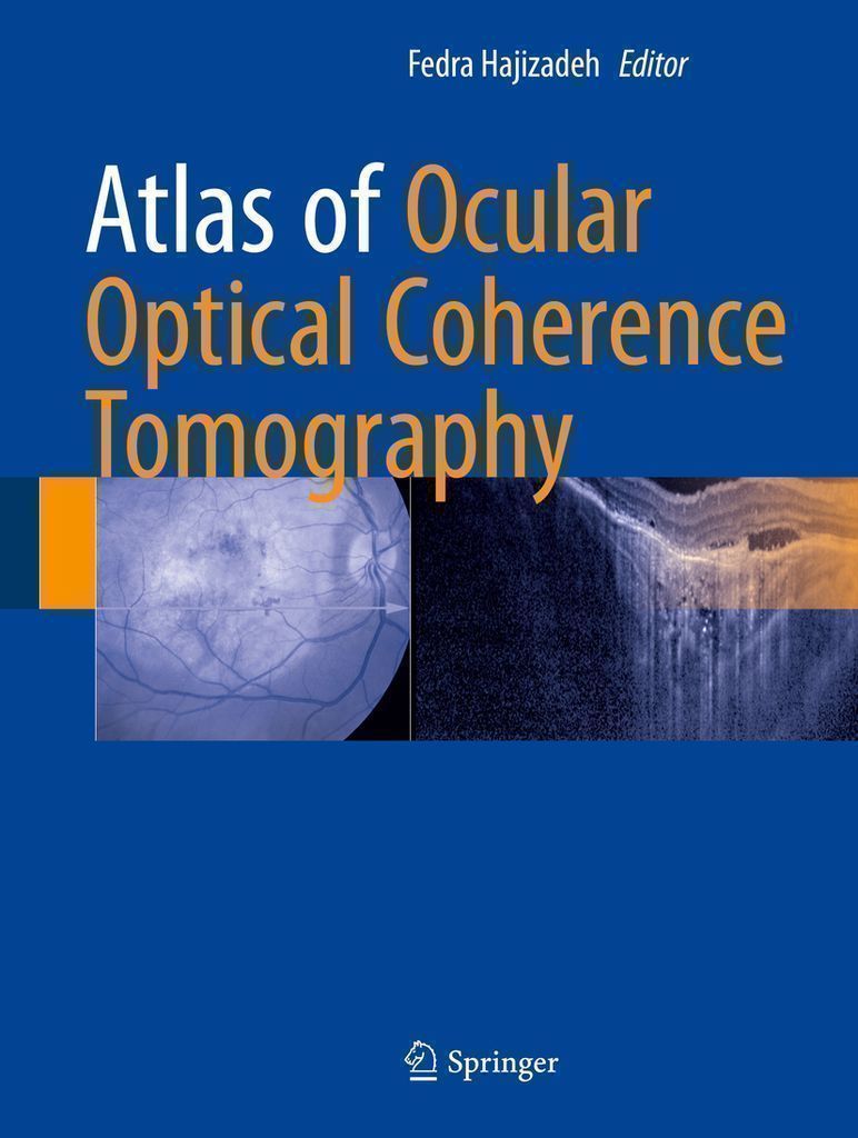 Cover image for Atlas of Ocular Optical Coherence Tomography