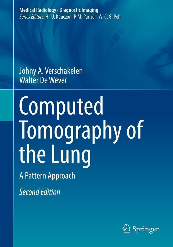 Cover image for Computed Tomography of the Lung