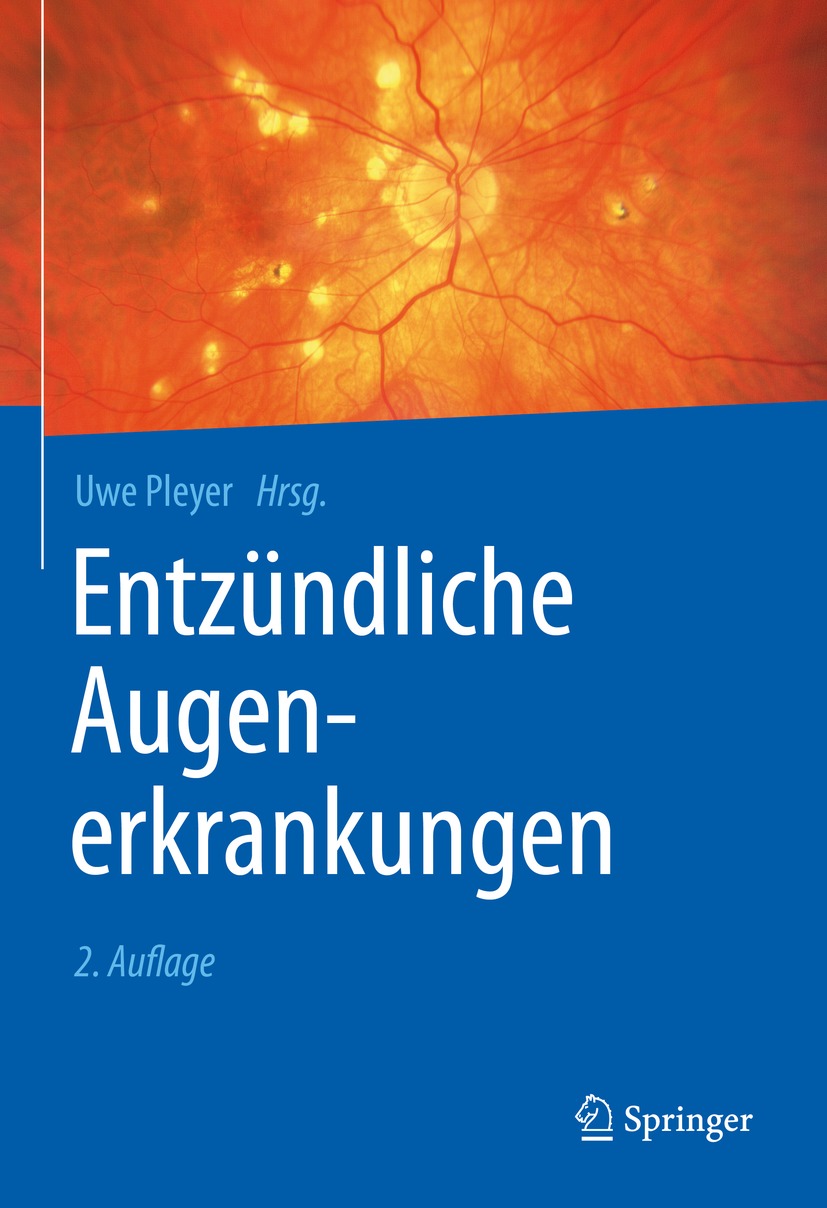 Cover image for Entzundliche Augenerkrankungen