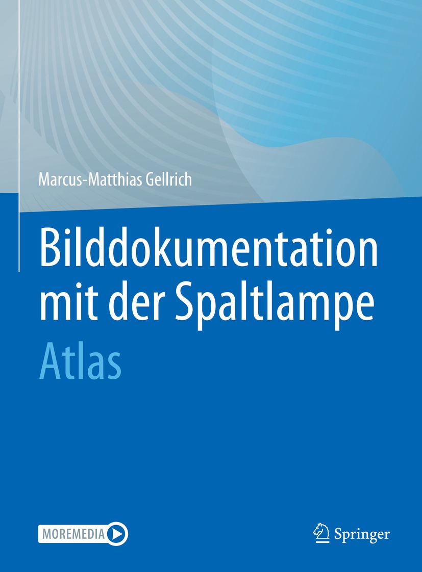 Cover image for Bilddokumentation mit der Spaltlampe