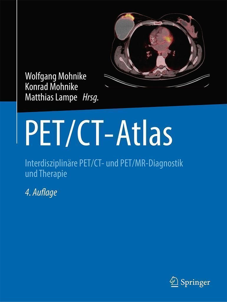 Cover image for PET/CT-Atlas