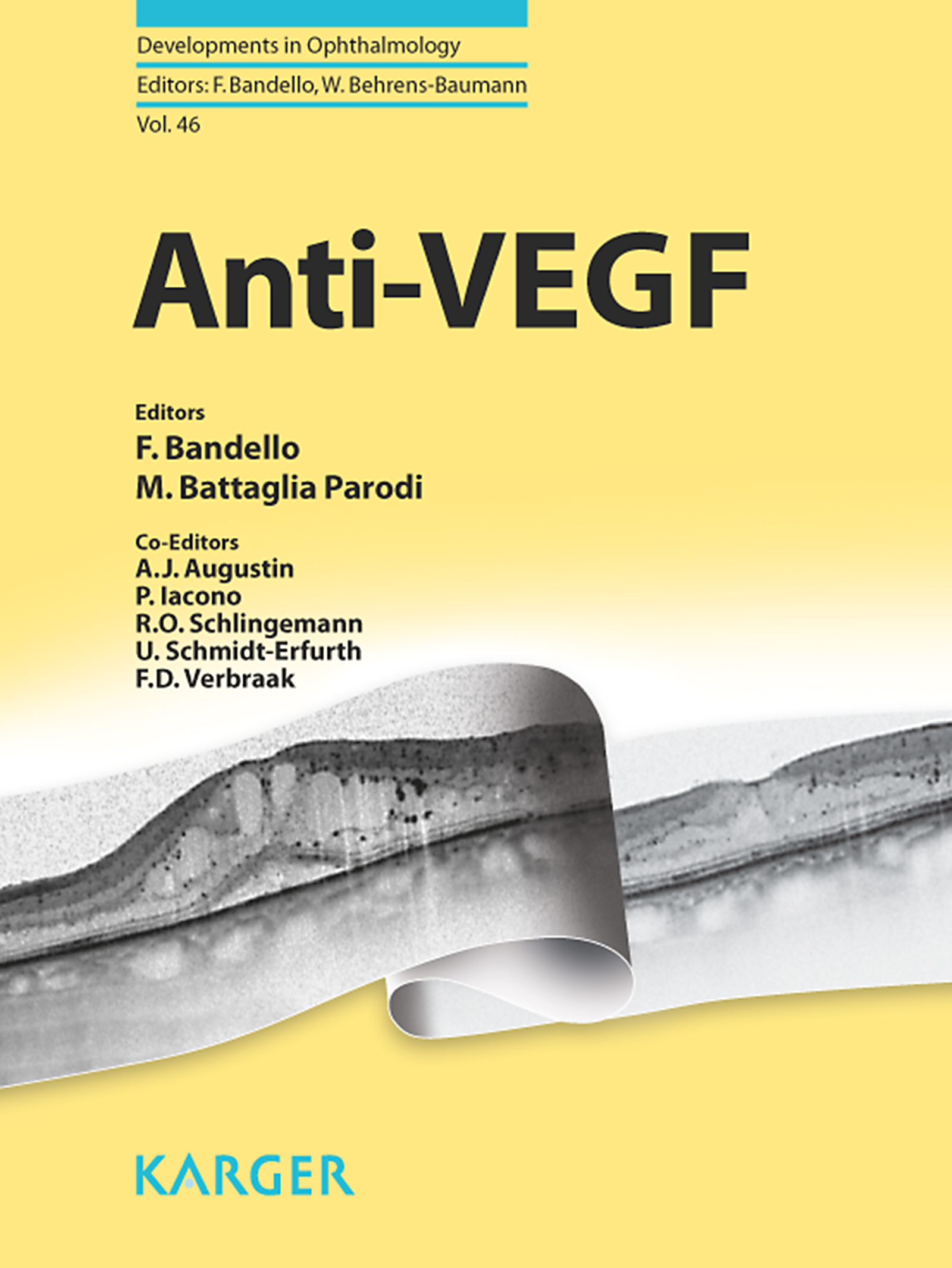 Cover image for Anti-VEGF