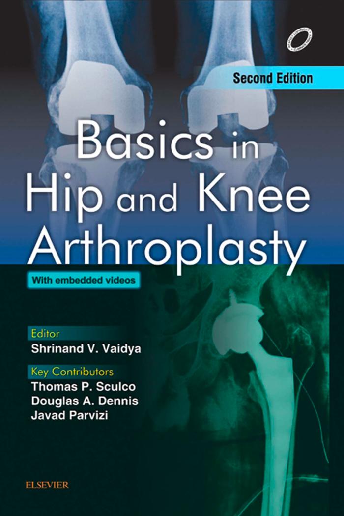 Cover image for Basics in Hip and Knee Arthroplasty - E-book