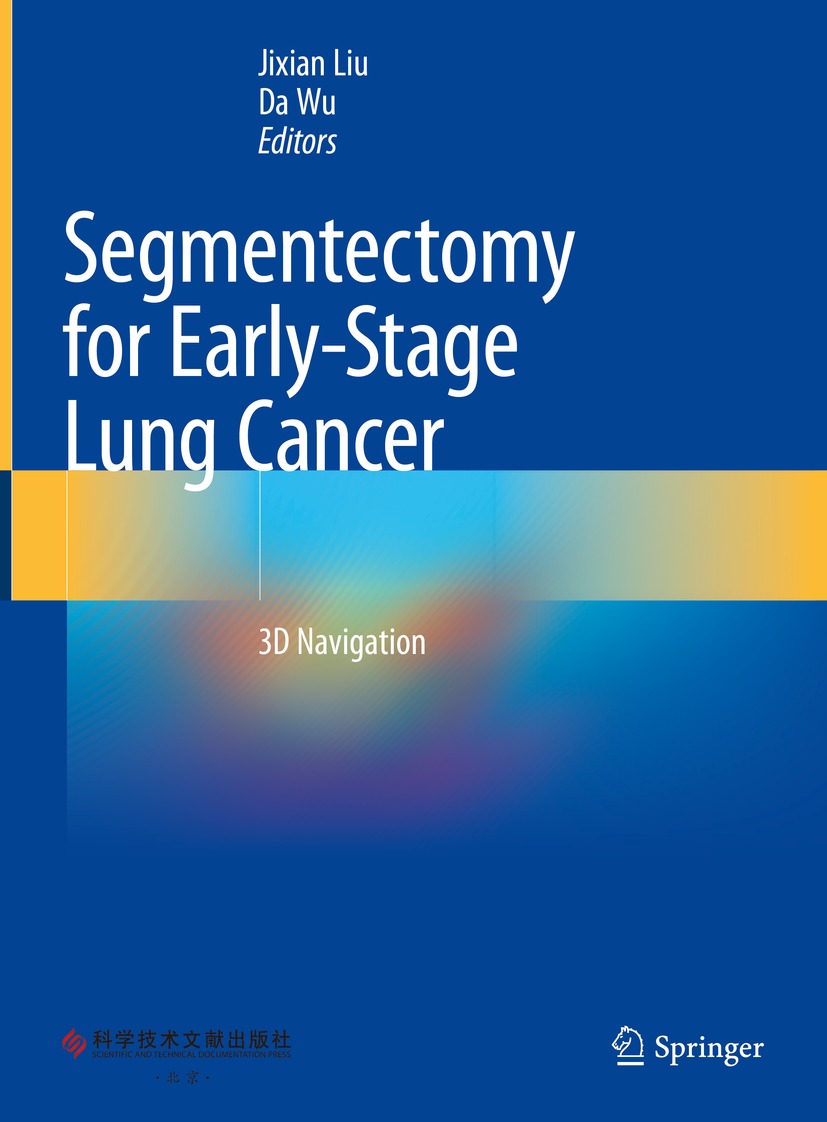 Cover image for Segmentectomy for Early-Stage Lung Cancer