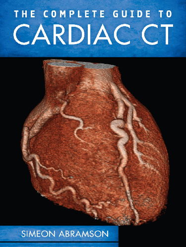 Cover image for The Complete Guide To Cardiac CT (PB)