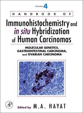 Cover image for Handbook of Immunohistochemistry and in situ Hybridization of Human Carcinomas