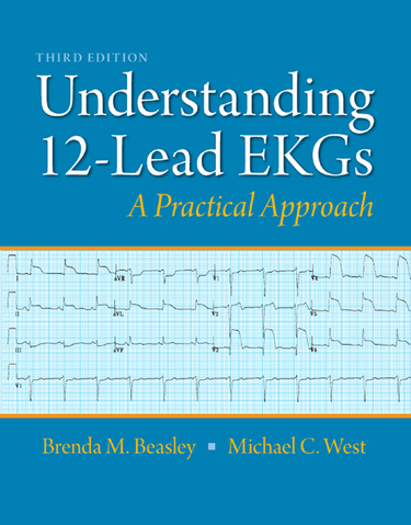 Understanding 12-Lead EKGs (Subscription)