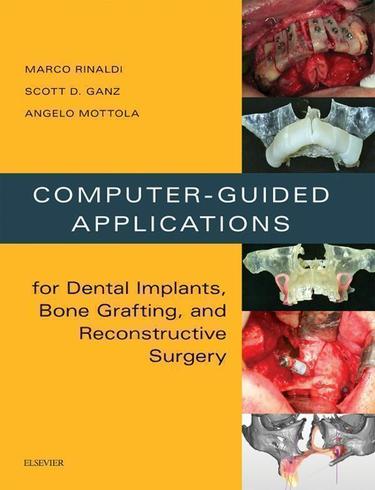 Cover image for Computer-Guided Dental Implants and Reconstructive Surgery