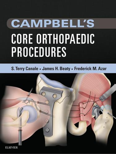 Cover image for Campbell's Core Orthopaedic Procedures E-Book