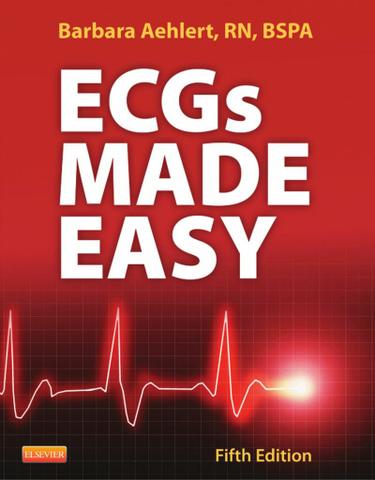 ECGs Made Easy - E-Book