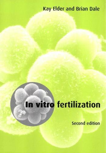 Cover image for In Vitro Fertilization