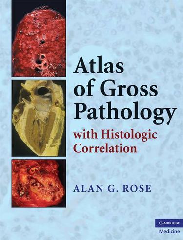 Cover image for Atlas of Gross Pathology