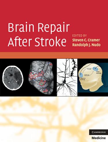 Cover image for Brain Repair After Stroke