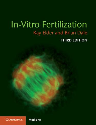 Cover image for In-Vitro Fertilization
