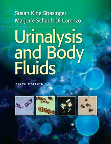 Urinalysis and Body Fluids