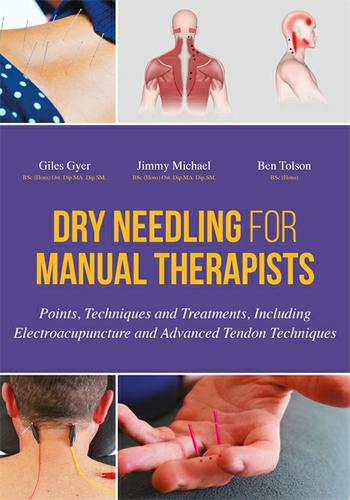 Cover image for Dry Needling for Manual Therapists