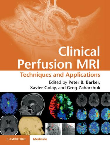 Cover image for Clinical Perfusion MRI