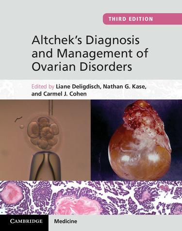 Cover image for Altchek's Diagnosis and Management of Ovarian Disorders