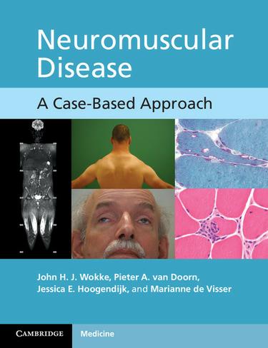 Cover image for Neuromuscular Disease
