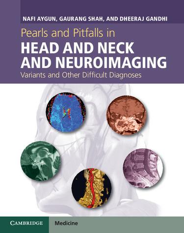 Cover image for Pearls and Pitfalls in Head and Neck and Neuroimaging