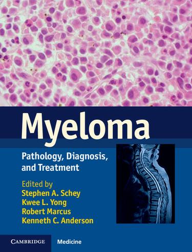 Cover image for Myeloma