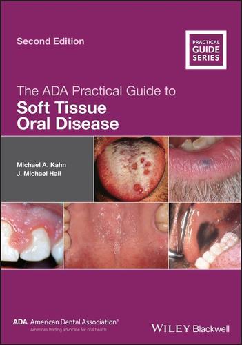 Cover image for The ADA Practical Guide to Soft Tissue Oral Disease