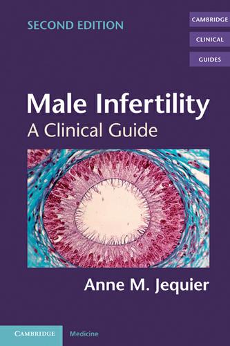 Cover image for Male Infertility