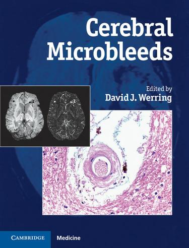 Cover image for Cerebral Microbleeds