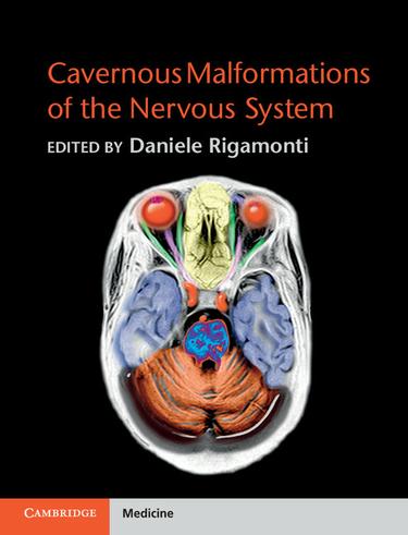 Cover image for Cavernous Malformations of the Nervous System