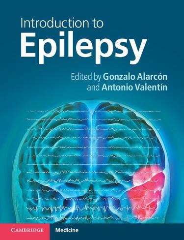 Cover image for Introduction to Epilepsy