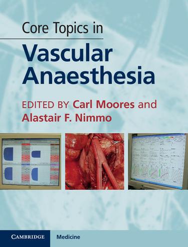 Cover image for Core Topics in Vascular Anaesthesia