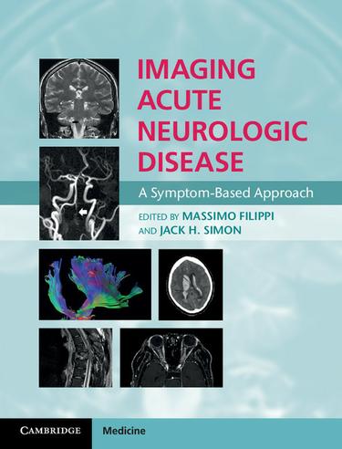 Cover image for Imaging Acute Neurologic Disease