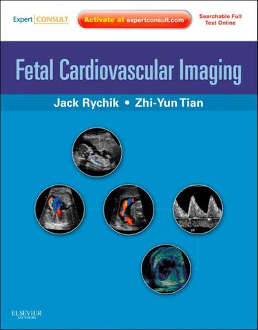 Cover image for Fetal Cardiovascular Imaging E-Book
