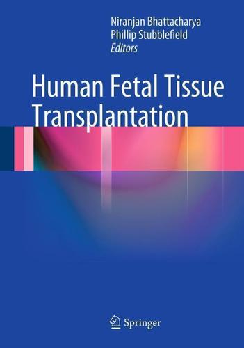 Cover image for Human Fetal Tissue Transplantation