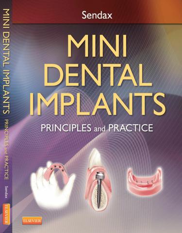 Cover image for Mini Dental Implants