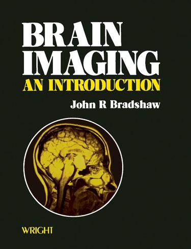 Cover image for Brain Imaging