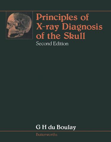 Cover image for Principles of X-Ray Diagnosis of the Skull