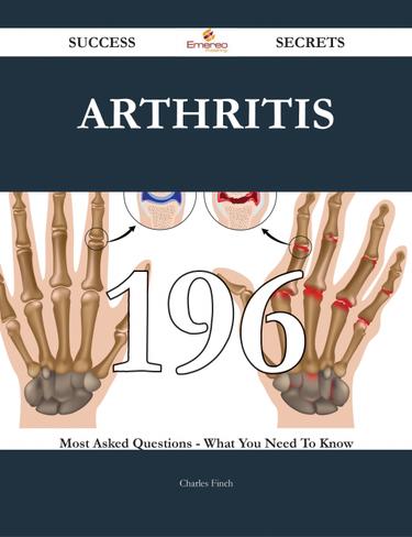 Arthritis 196 Success Secrets - 196 Most Asked Questions On Arthritis - What You Need To Know
