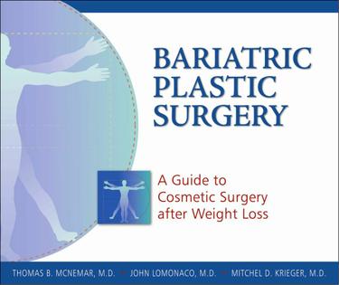 Cover image for Bariatric Plastic Surgery
