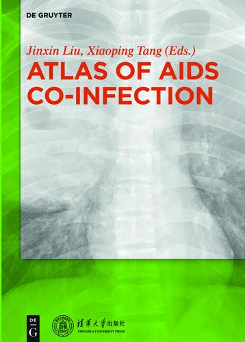 Cover image for Atlas of AIDS Co-infection