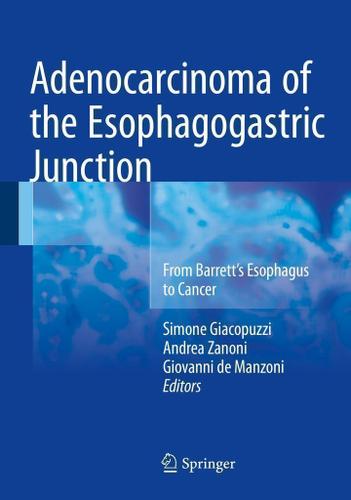 Cover image for Adenocarcinoma of the Esophagogastric Junction