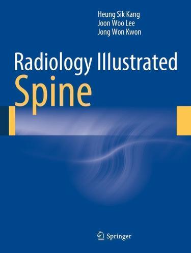 Cover image for Radiology Illustrated: Spine