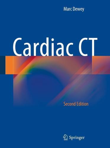 Cover image for Cardiac CT