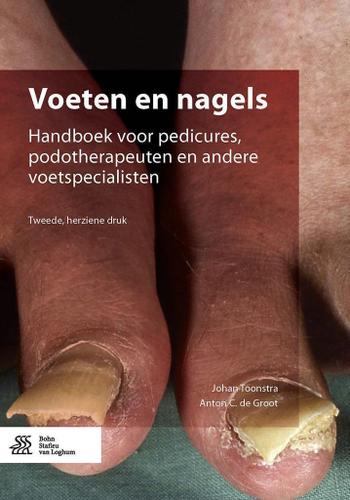Cover image for Voeten en nagels