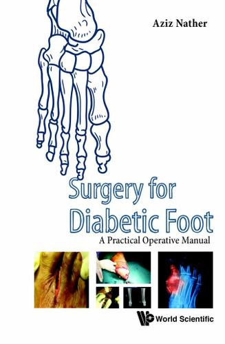 Cover image for SURGERY FOR DIABETIC FOOT: A PRACTICAL OPERATIVE MANUAL